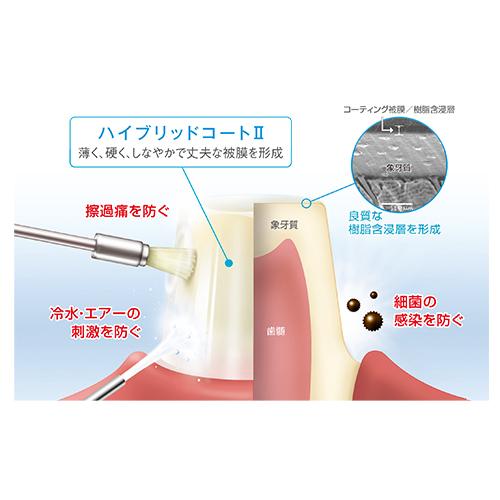 ハイブリッド コート 2 安い 保険